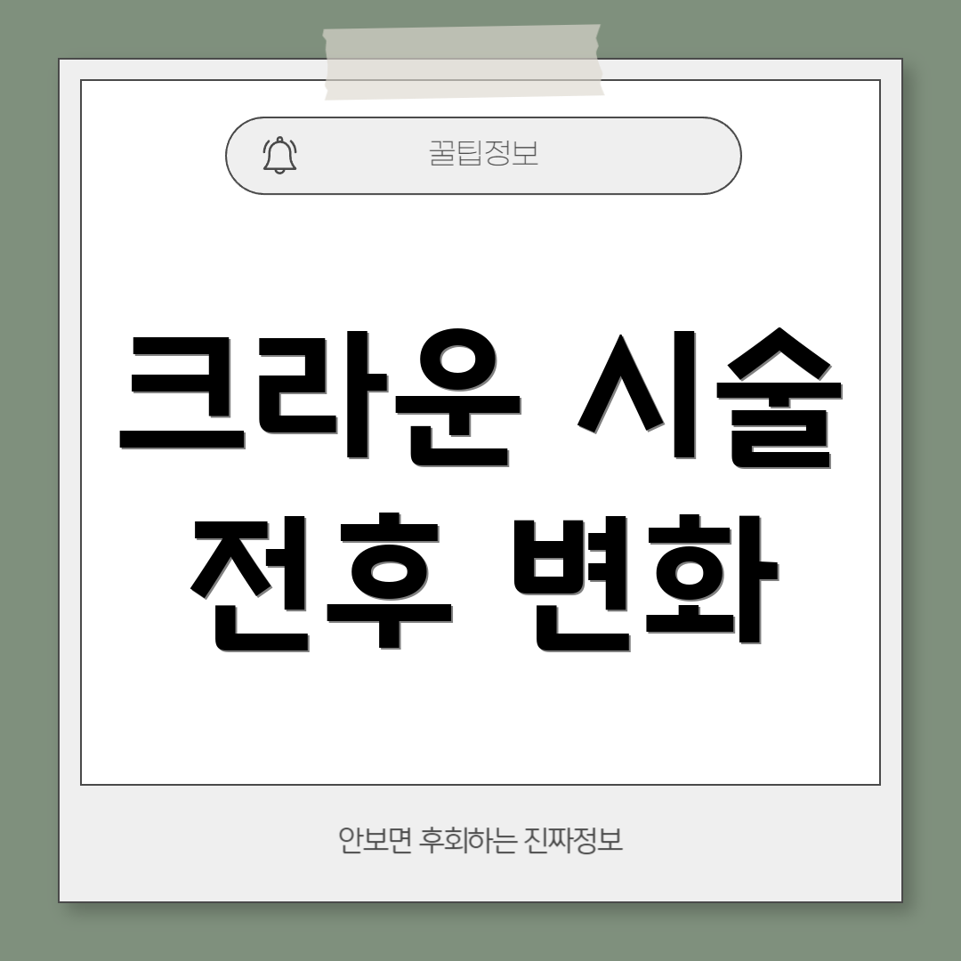 크라운 시술 전후 변화